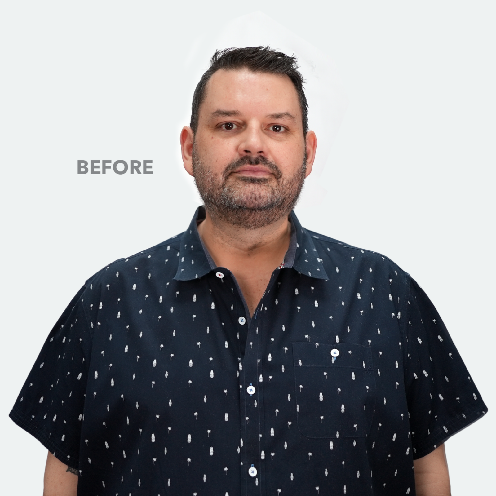 Before (dress shirt)